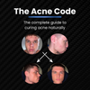 The Acne Code